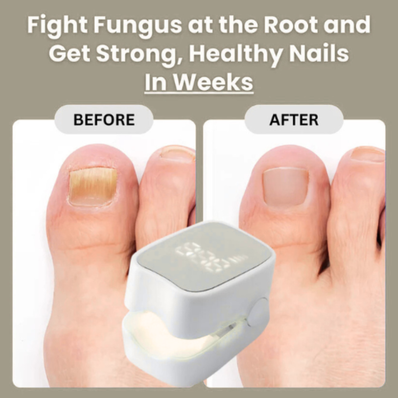 Makelsa™ - Nail Fungus Laser Device