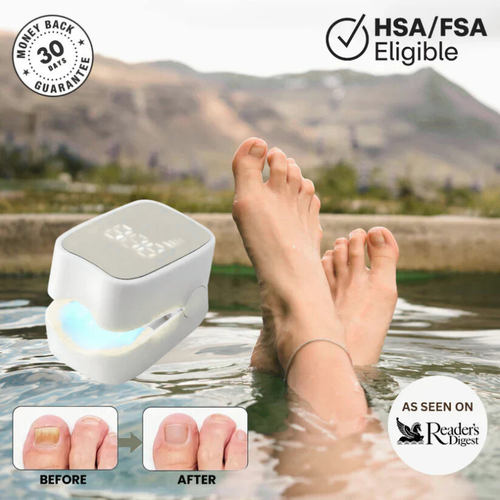 Makelsa™ - Nail Fungus Laser Device